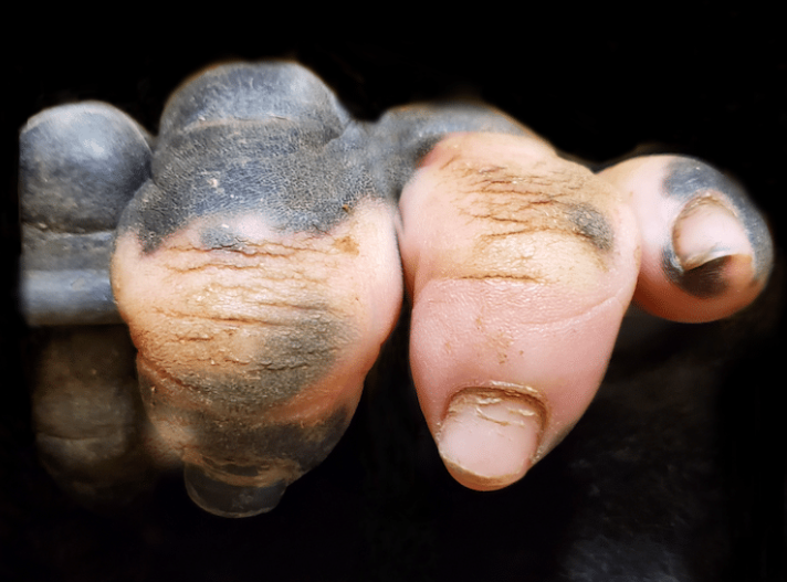 The Fingers Of a Gorilla With Vitiligo Almost Looks Like Pink Human FIngers 2