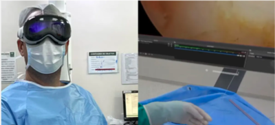 Brazilian Surgeon Uses Apple Vision Pro To Conduct Surgery On a Patient