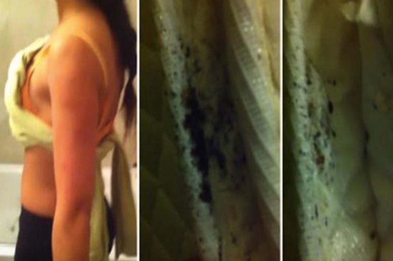 Video: This Footage Of A Bed Bug Infestation In A New York Hotel Will Haunt You Forever... 1