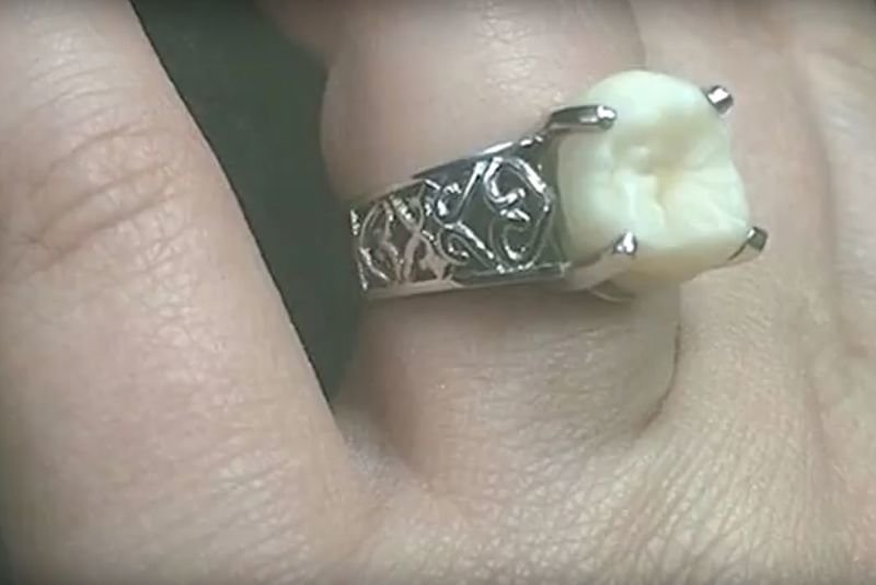 Video: Strangest Engagement And Wedding Rings! 1