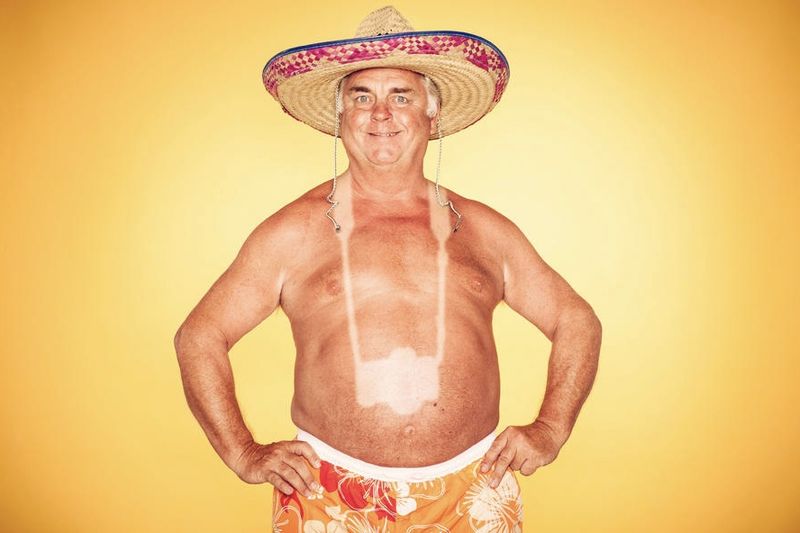 Video: No, Your Oozing, Peeling Sunburn Will Not Make You Into A Golden Godess 1