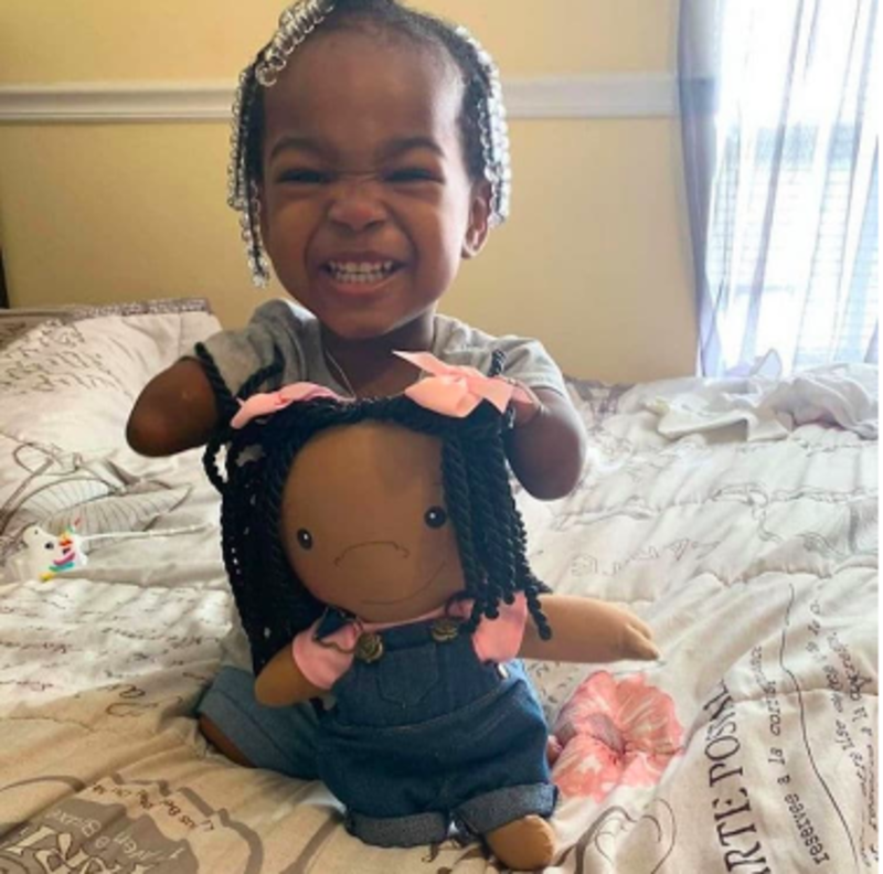 Compassionate Artist Creates Look-Alike Dolls For Children With Physical Differences 1