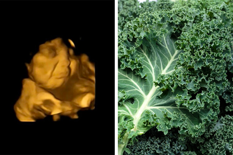 Study Shows Unborn Babies Disgusted When Mothers Ingest Kale 1