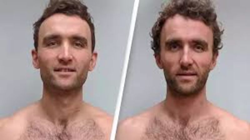 Identical Twins With Different Diets Conduct Study On The Different Body Changes 1