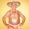Video: No, Your Oozing, Peeling Sunburn Will Not Make You Into A Golden Godess