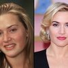 Video: Insane Celeb Before And After Pics That Prove Natural Beauty Is Best! 2