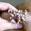Video: Worms That Belong In Nightmares Could Be Feeding On Your Flesh!