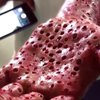 Video: Worms That Belong In Nightmares Could Be Feeding On Your Flesh!