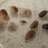Video: Worms That Belong In Nightmares Could Be Feeding On Your Flesh!