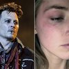 Video: Fans Become Concerned Over Johnny Depp's Health Crisis