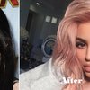 Video: Kylie Jenner Claims To Be Ditching Her Lip Fillers 4