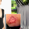 Shark Attack Survivor '10/10' Swimsuit Review Goes Viral