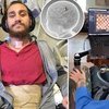 First Paralysed Man To Receive Neuralink Chip By Elon Musk, Reveals Life Changing Effects
