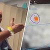 Ultrasound Therapy Incredibly Cures Man With Tremors In His Hand