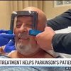 Ultrasound Therapy Incredibly Cures Man With Tremors In His Hand